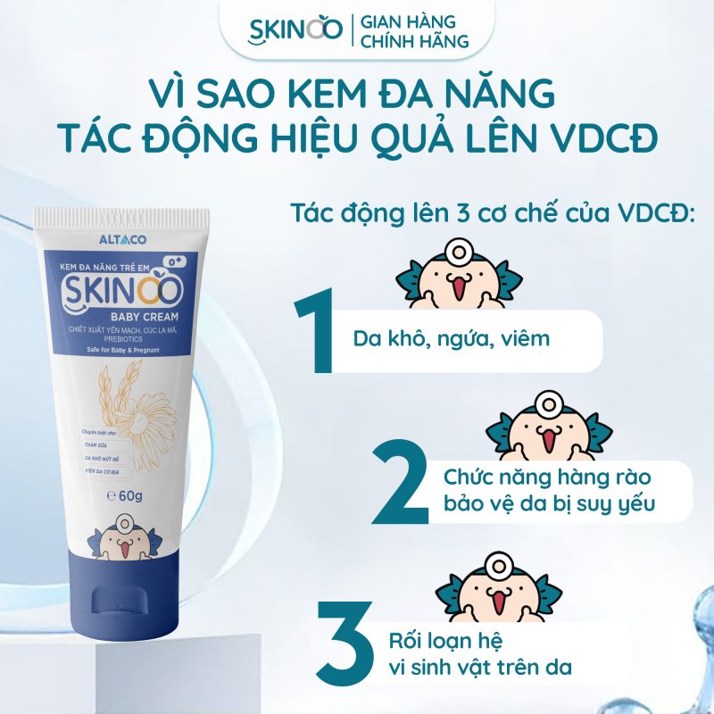 kem dưỡng ẩm cho bé đa năng skinoo baby cream tác động viêm da cơ địa