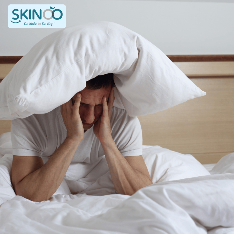 rối loạn giấc ngủ là triệu chưng viêm da cơ địa