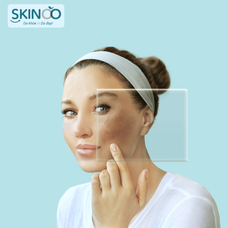 sản phẩm phục hồi hàng rào bảo vệ da (4)