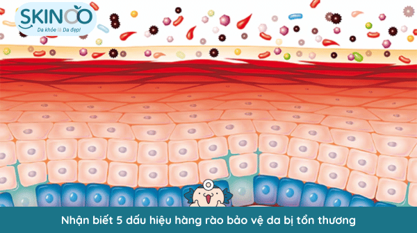 nguyên nhân khiến hàng rào bảo vệ da bị tổn thương