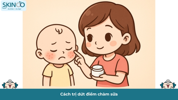 Cách trị dứt điểm chàm sữa